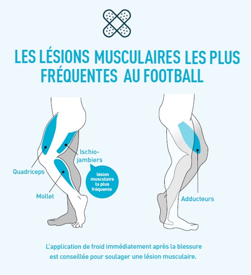 Lesions musculaires