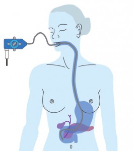 Vocation32-Gastrocopie-Schema