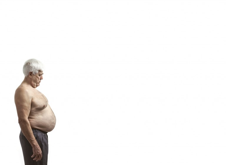 L’obésité fait vieillir plus vite Vocation