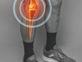 Arthrose
