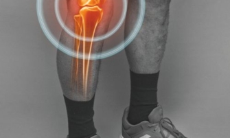 Arthrose