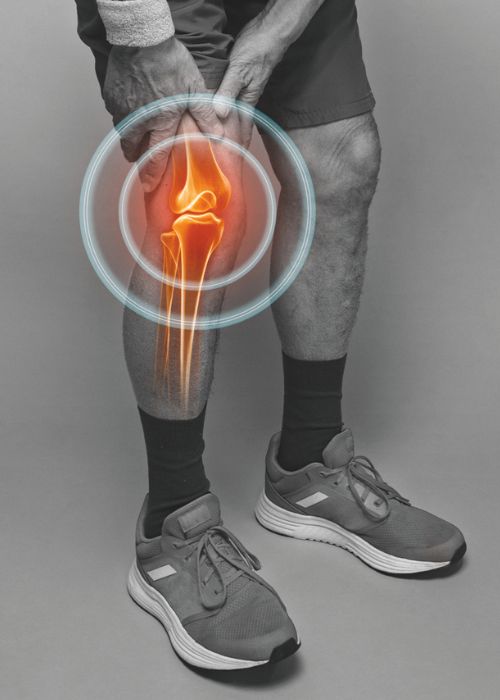 Arthrose