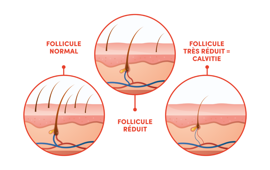 processus chute de cheveux