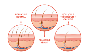 processus chute de cheveux